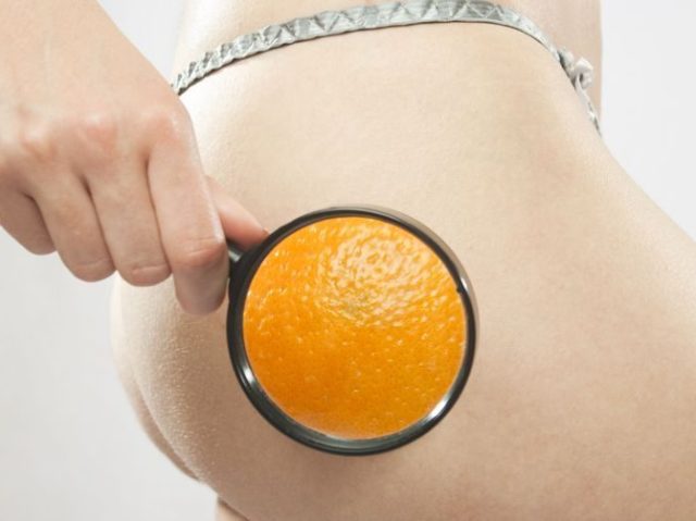 Ouvir a cliente falar que quer tratar a “casca de laranja”.