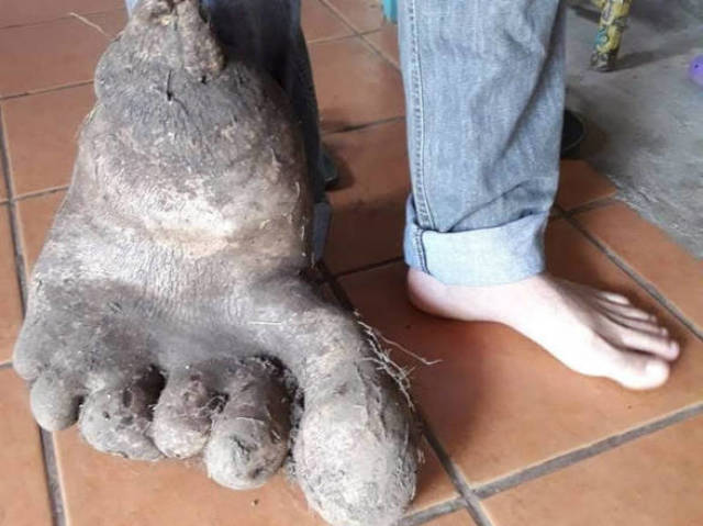 O homen que mais fuma e come sigarros de Petrolina-PE