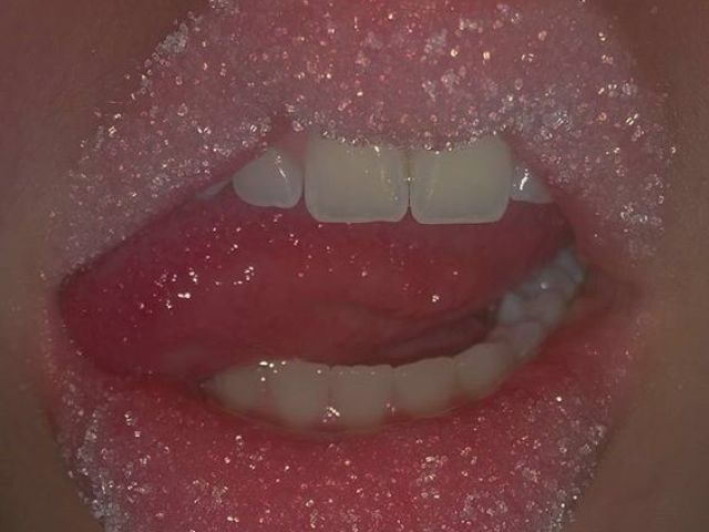 Sugar