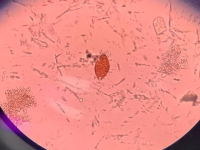 Trichuris