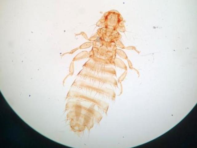 Heterodoxus