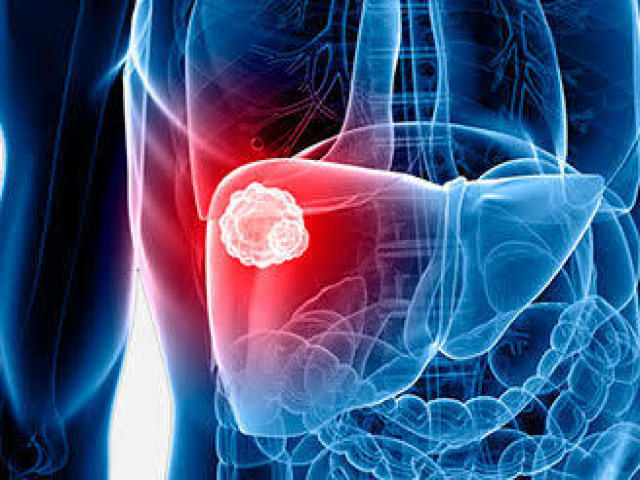 Tema: Hepatite.