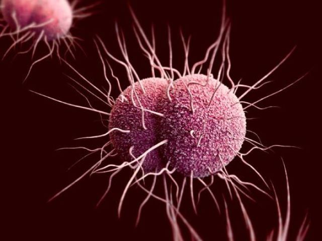 Neisseria gonorrhoeae