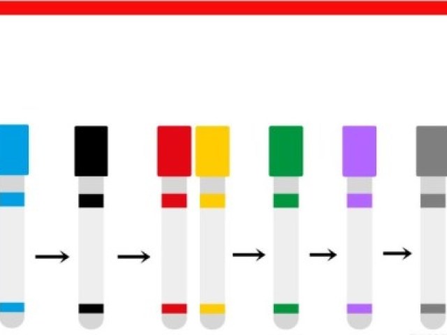 Azul: Plasma
Preto: hemosedimentação
Vermelho/amarelo: bioquímicos
Verde: Bioquímicos em diluição
Roxo: liquor
Cinza: glicose