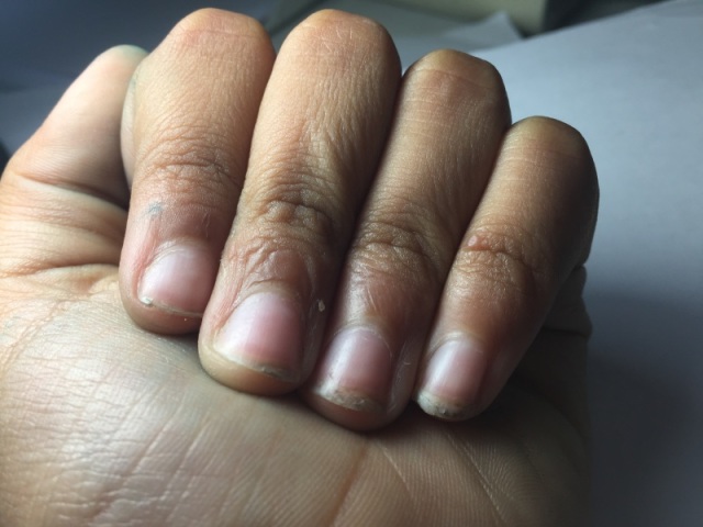 Não tenho e nem quero unhas