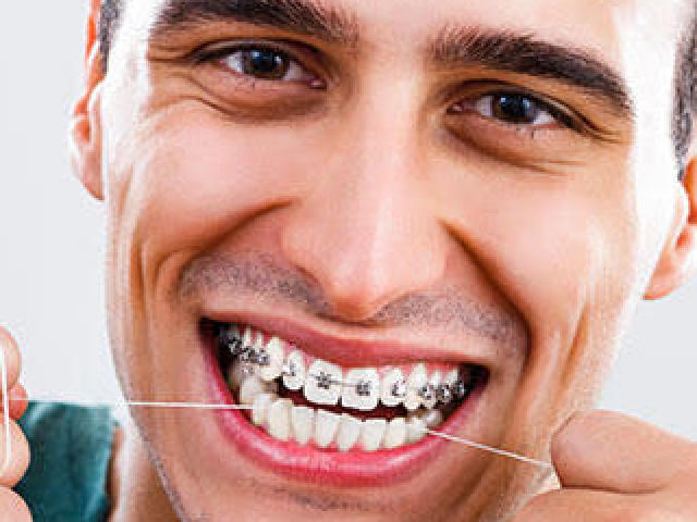 Nunca usou aparelho nos dentes