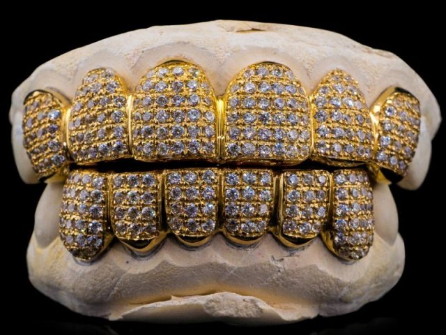 Um grillz cheio de diamantes