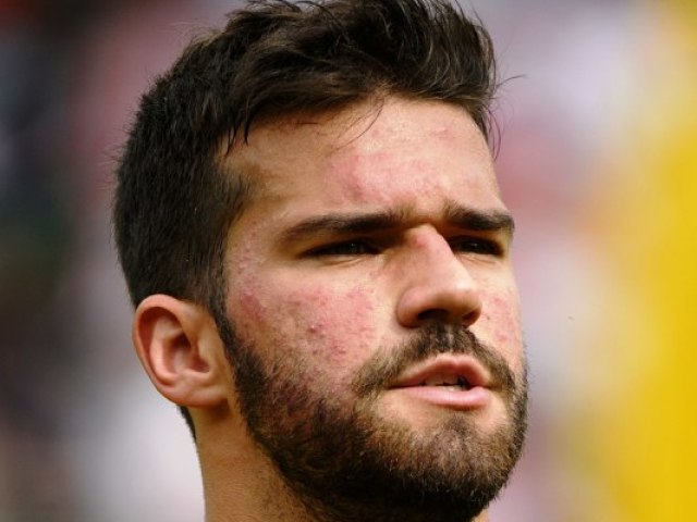 Alisson Ramses Becker