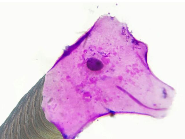 Braquiossauro de células escamosas