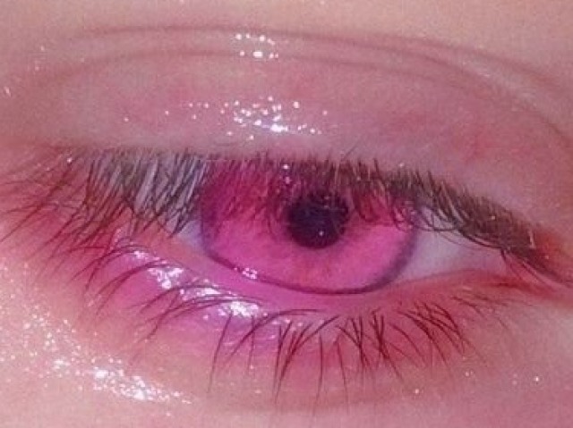 👁♡👁