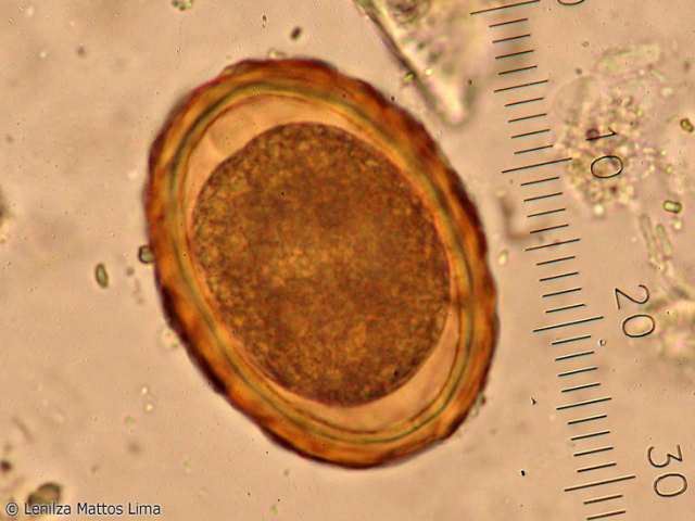 Cisto de Ascaris lumbricoides