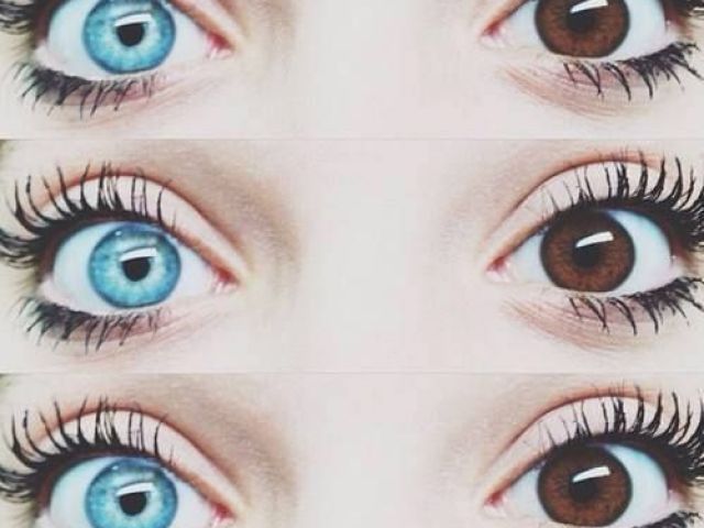 Heterocromia azul/castanho π