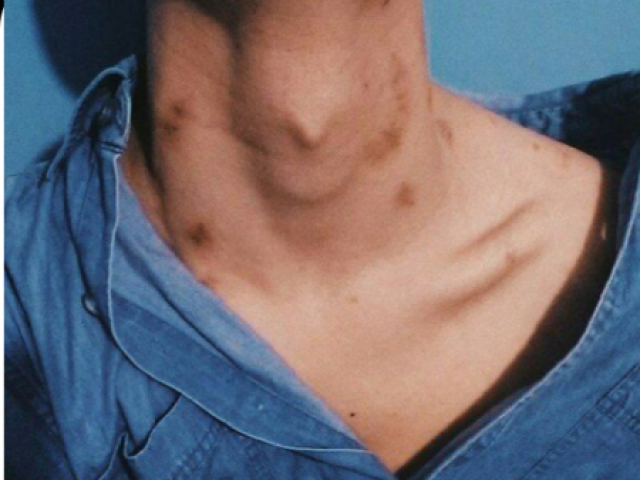 Neck