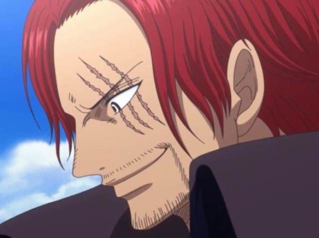 Shanks