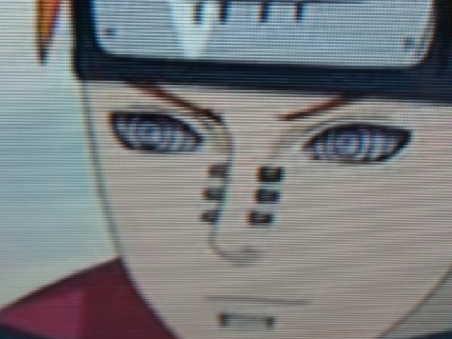 Pain