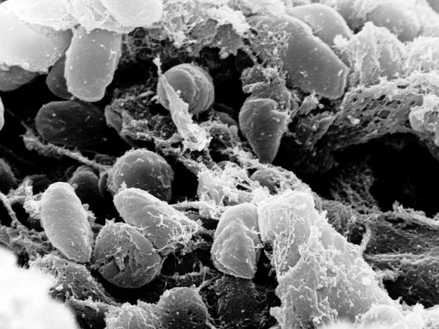 Yersinia pestis( Peste Negra)