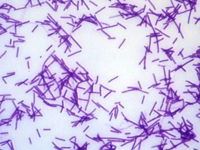 Clostridium tetan
( Tétano)