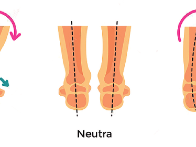 Neutra