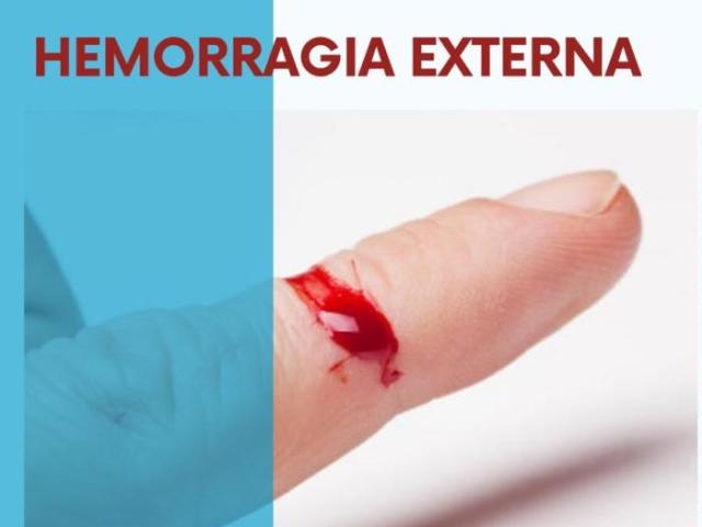 Hemorragia externa: de fácil avaliação e visibilidade.