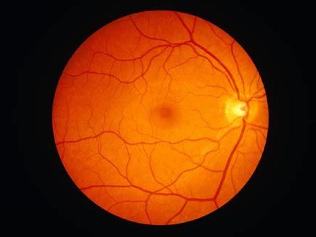 Retina