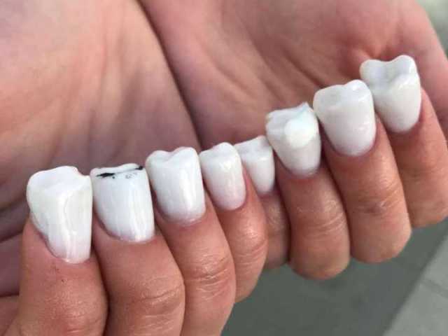 Unhas de dente