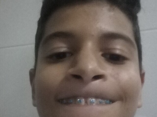 Erick feião