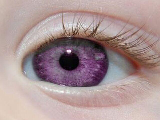 roxo