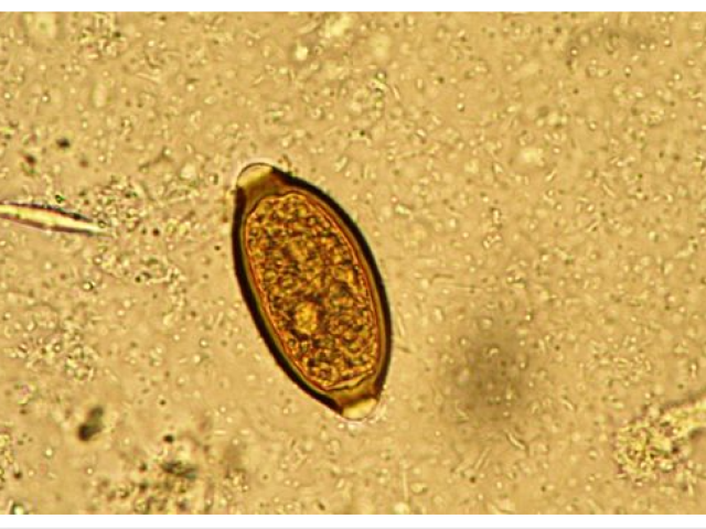 Trichuris spp.