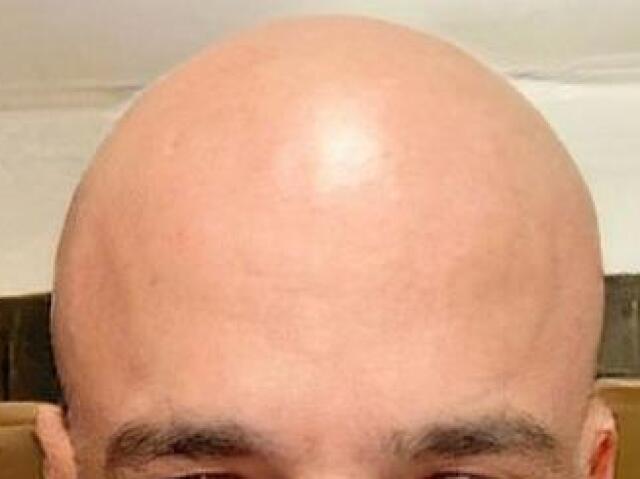 Careca
(Homem)