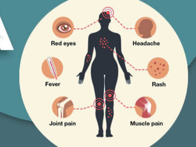 Dor no corpo, manchas vermelhas na pele