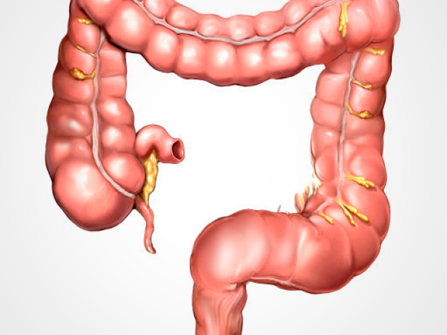 Intestino Grosso