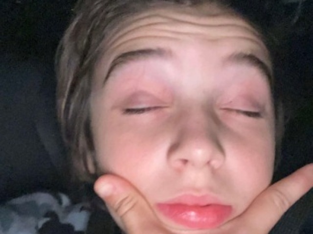 o