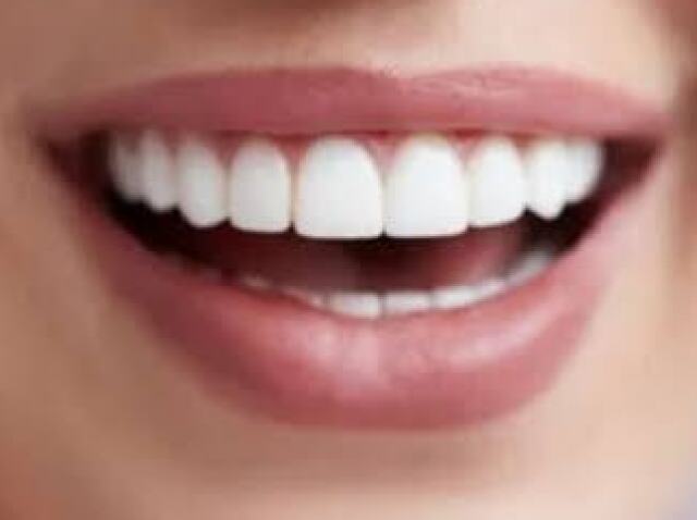 Um sorriso com dentes separados/só os das frente que são separados