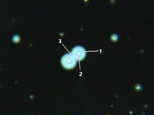 Cryptococcus neoformans