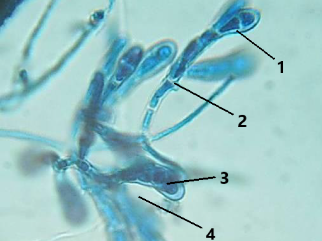 Epidermophyton floccosum