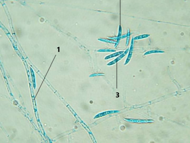 Fusarium sp.