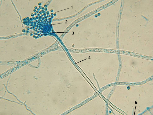 Aspergillus sp.