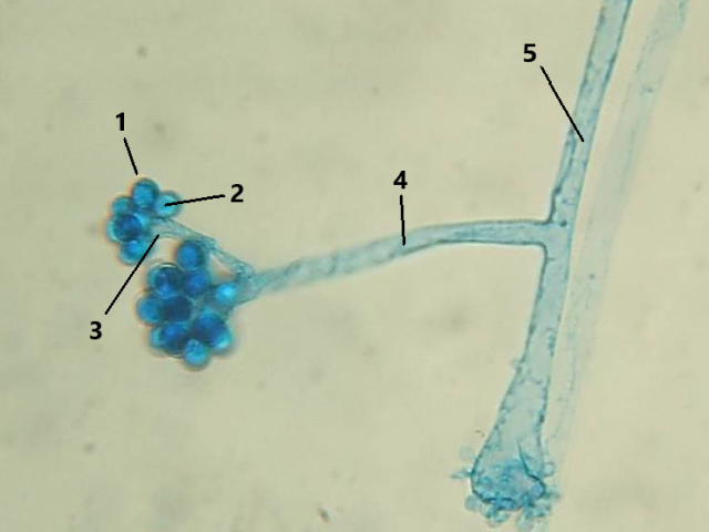 Cunninghamella sp.
FSH (Filamentoso Septado Hialino)
Esporângios Esféricos com Múltiplos Esporangiósporos