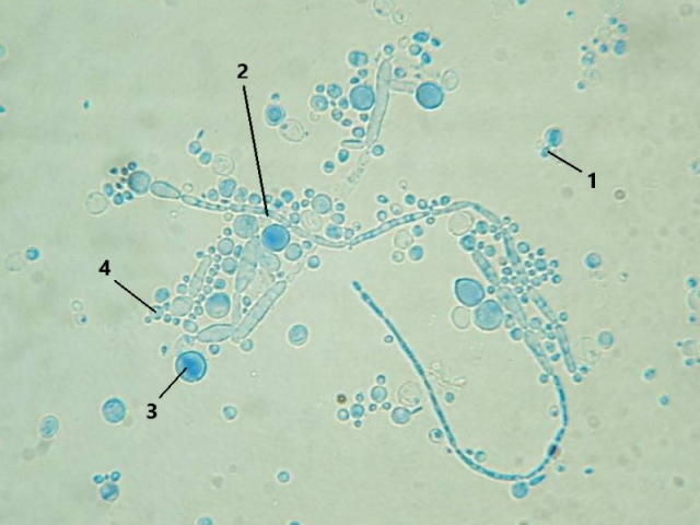 Candida albicans
LH (Leveduriforme Hialino)
Pseudo-hifas (2) e Clamidoconídios (3)