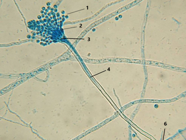 Aspergillus sp.
FSH (Filamentoso Septado Hialino)
Conídios Catenulados (1) e Fiálides (2)