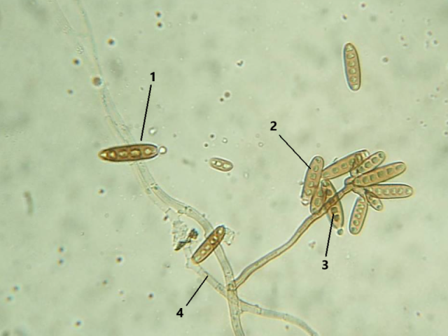 Drechslera sp.
FSD (Filamentoso Septado Demáceo)
Conídios Elípticos (1) de Parede Espessa (2)