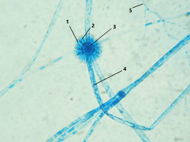 Syncephalastrum sp.