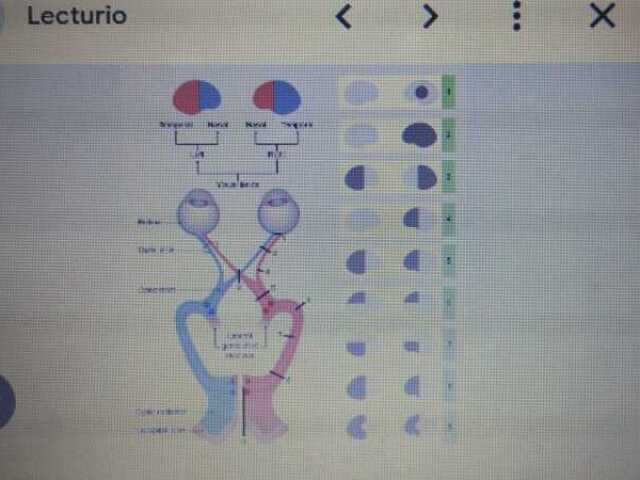 TEMPORAL IZQUIERDO Y NASAL DERECHO