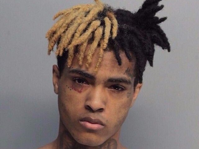 XXXTENTACION