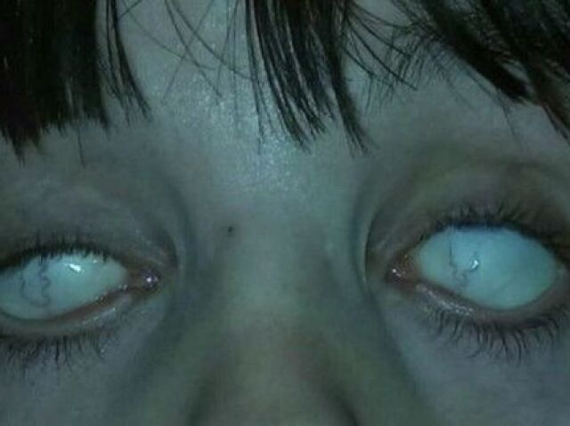 Olhos ektropĂ: VocĂȘ possui poder sobre seres sobrenaturais