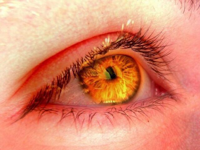 Olhos imĂ©ra: VocĂȘ possui poder sobre os dias de sol e seus elementos