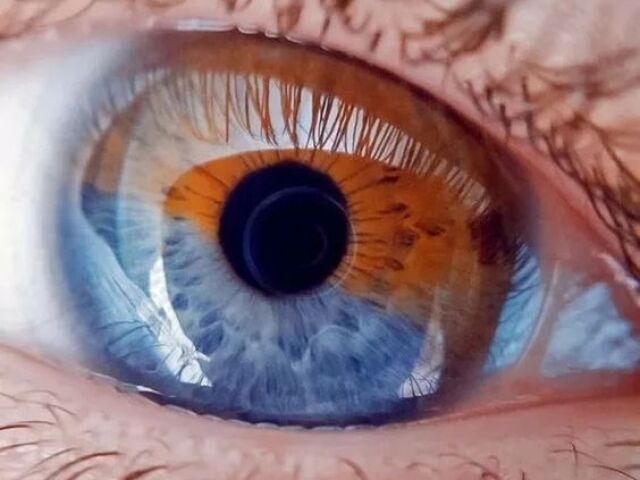 Olhos gemĂȘos: VocĂȘ pode controlar o frio e o calor