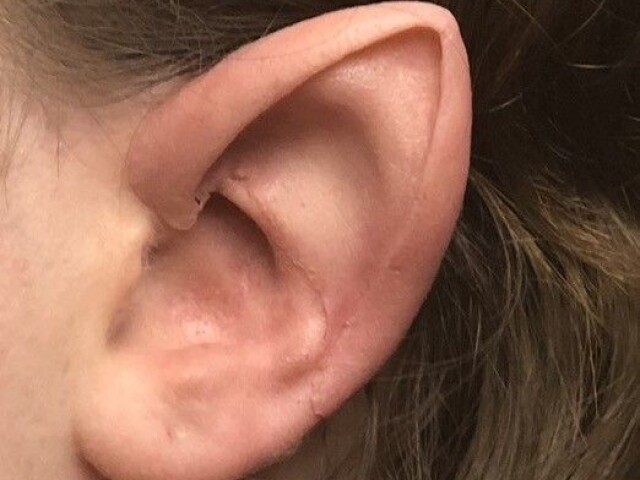 👂