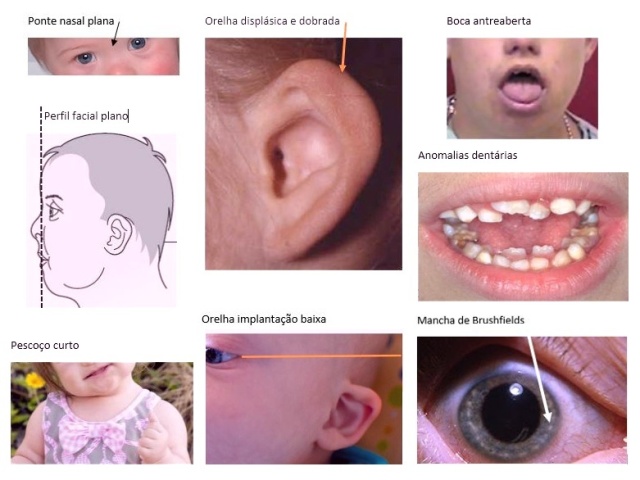 CERTO
