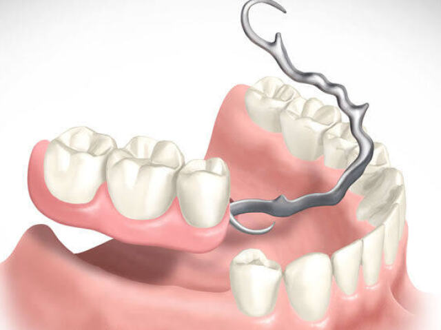 Pessoas com próteses dentárias